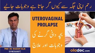 Uterovaginal Prolapse Causes amp Treatment  Pelvic Organ Prolapse  UterineReham Ke Girne Ka Ilaj [upl. by Hras]