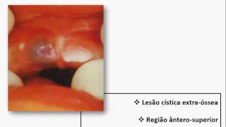 ODONTOLOGIA FacidDeVry  Resolução questões ENADE [upl. by Nolyaj]