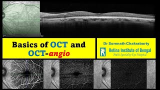 OCT and OCTAngiography an introduction [upl. by Richy]