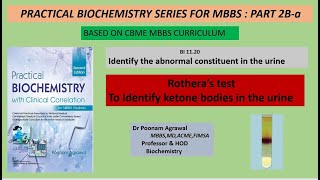 Rotheras Test  Ketone Body Detection in Urine  Sodium Nitroprusside Test  MBBS Practical  CBME [upl. by Bringhurst734]