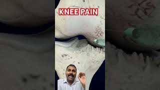 For people who requested knee injection video in hindhi [upl. by Tobie696]