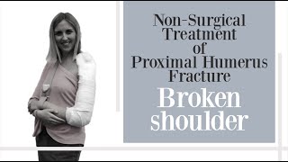 non surgical treatment of proximal humerus fracture [upl. by Flanders]