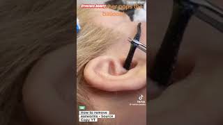 WORMS IN THE EARS YOU WON’T BELIEVE THIS 🙀 How To Remove EARWORMS from the Ears [upl. by Delos644]