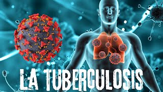 5 Minutos con el NEUMOLOGO La TUBERCULOSIS1 [upl. by Enelrats383]