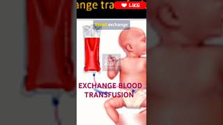 EXCHANGE BLOOD TRANSFUSION  rrb nursingimportantquestions norcet8 exchangebloodtransfusion [upl. by Lipp106]