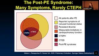 Chronic Thromboembolic PH Alice Goyanes MD [upl. by Haveman643]