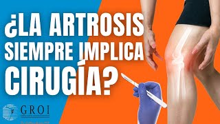 ¿La artrosis siempre implica cirugía 🤔💥🦵 MitosArtrosis artrosisderodilla artrosis artroscopia [upl. by Ffej]