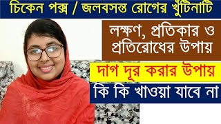 চিকেন পক্সজলবসন্ত রোগের লক্ষণ চিকিৎসা ও প্রতিরোধের উপায় All About Chicken Pox  Treatment amp Others [upl. by Prebo759]