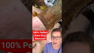 😍 Perfect PORE STRIP REMOVAL shorts [upl. by Laurinda]