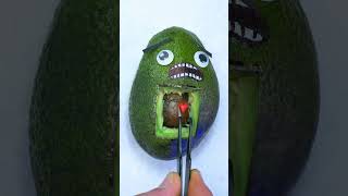 The Avocado Makeover Surgical Secrets Revealed 🥑✨ [upl. by Base]