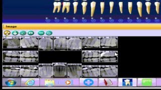 Guru Teach  integration with Dentrix and Dexis [upl. by Seraphina]