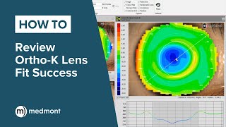 HowTo  Review OrthoK lens fit success [upl. by Ahsinar707]