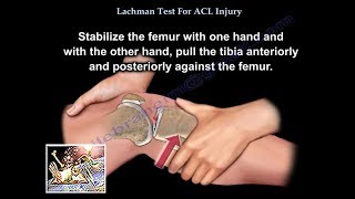 Lachman Test ACL Injury  Everything You Need To Know  Dr Nabil Ebraheim [upl. by Aeikan959]