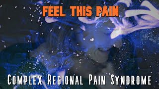 Complex Regional Pain Syndrome Feel This Pain S2E2 [upl. by Iy]