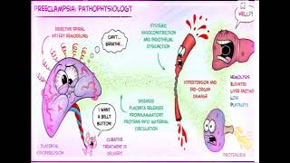 pathophysiology of preeclampsia [upl. by Honna]