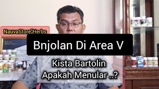 Benjolan Di V Kista Bartolin Apakah Menular [upl. by Hyrup]