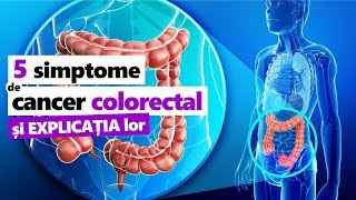 5 SIMPTOME EXPLICATE Cancer de Colon  Colorectal [upl. by Alvie]