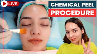 CHEMICAL PEELS Step by Step  Acne Scar Treatment in Delhi  Chemical Peeling Treatment Dr Jangid [upl. by Suchta]