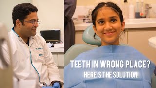 TEETH IN WRONG PLACE How To Fix dentist shortsindia [upl. by Adnor620]