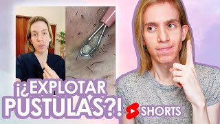 Como NO tratar los granos con pus  Recomendación de un Dermatólogo shorts [upl. by Rhetta]