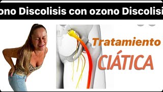 Ciatica y ozonoterapia [upl. by Guthrey]