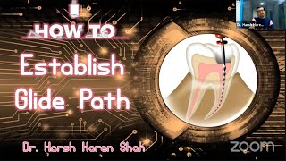 How to establish Glide Path LECTURE CUM DEMONSTRATION  Webinar by Dr Harsh Haren Shah [upl. by Leavy]