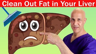 1 Teaspoon Cleans Out Fat in Your Liver  Dr Mandell [upl. by Ecikram560]