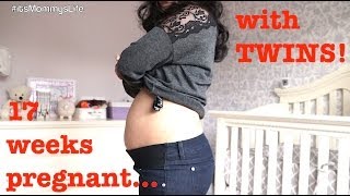 17 Week Pregnancy Update with TWINS  itsMommysLife [upl. by Llemij347]