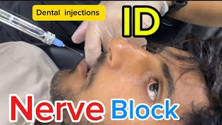 Dental injections pain 🦷🥹🇵🇰 Dental anesthesia  ID Nerve Block [upl. by Adran]