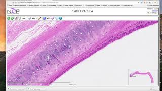 Hyaline cartilage histology demonstration [upl. by Alguire]