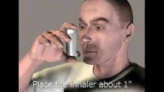 3D Medical Animation Inhaler [upl. by Micky]