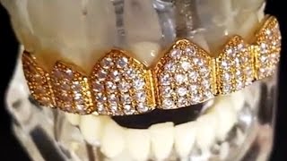 18K Gold Plated CZ Bling Top Teeth Hip Hop Grillz [upl. by Asilam]