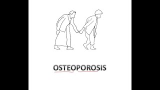 Osteoporosis Pathophysiology [upl. by Pomona]