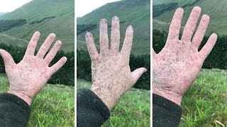 Giant Swarm Of Midges Stick To Hand In Scotland [upl. by Hokanson653]