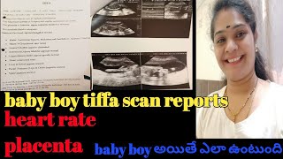 baby boy tiffa scan reports baby heart rate baby placenta position in tiffa scan reports tiffa [upl. by Nevil]