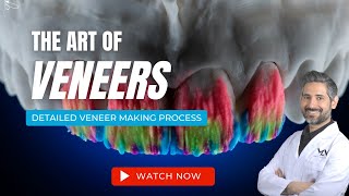 Making Porcelain Veneers  The Art of Veneers [upl. by Nylsoj]