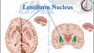 Brain Anatomy 13 Basal Ganglia 2 Lentiform NucleusInternal CapsuleClaustrum [upl. by Harrat]