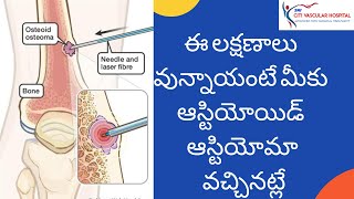 Osteoid Osteoma  causes symptoms and ablation treatment  ఆస్టియోయిడ్ ఆస్టియోమా అధునాతన చికిత్స [upl. by Llimaj]