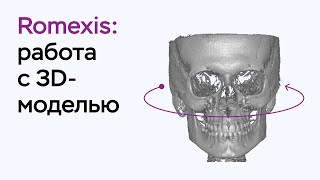 Возможности программы Romexis Viewer работа с 3Dмоделью [upl. by Edrahc]