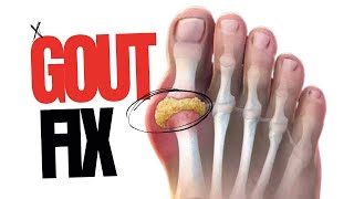 Gout Relief Natural Solution [upl. by Evetta198]