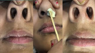 Nose hair waxing by Rica Brazilian Waxnosehairwaxingwaxingtipswaxing skincarepummybeautyworld [upl. by Oona]