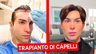 TRAPIANTO DI CAPELLI LA MIA ESPERIENZA  GIANMARCO ZAGATO [upl. by Erline219]