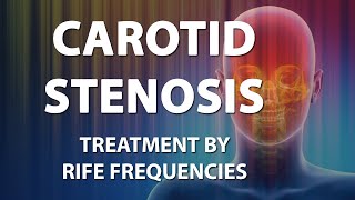 Carotid Stenosis Artery  RIFE Frequencies Treatment  Energy amp Quantum Medicine with Bioresonance [upl. by Atinaj171]