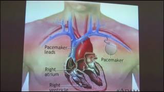 Cardiovascular system Examination [upl. by Drape]