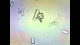 Feline Urine Sample with Struvite Crystals 4 Microscope Camera [upl. by Steady]