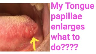 Enlarged tongue papillaeFoliate papillae enlarges whyI have enlarged tongue Papillae what to do [upl. by Fabyola570]