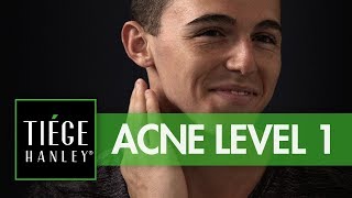 Tiege Hanley Acne System Level 1  Tiegecom [upl. by Aynahs433]