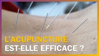 Lacupuncture estelle efficace [upl. by Padraic]