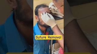 Suture Removal neet doctorlife medico art mbbs medicalstdents doctor mbbsasist medical [upl. by Hallerson]