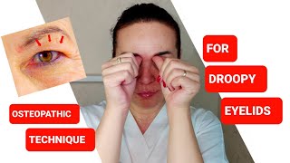 One easy OSTEOPATHIC technique for DROOPY EYELIDS [upl. by Nanine]